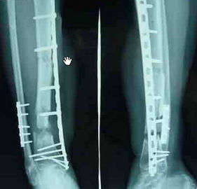 Good price کاغذ پزشکی لیزر پرینتر تصویربرداری تشخیصی X Ray برای بیمارستان آنلاین