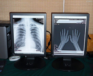 صفحه نمایش پزشکی 2MP با کیفیت بالا پزشکی