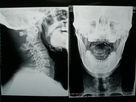 فیلم تصویربرداری پزشکی ایکس ری