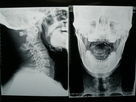 Good price فیلم تصویربرداری پزشکی با چگالی بالا ، X X ray خشک برای فوجی 3000/2000/1000 آنلاین