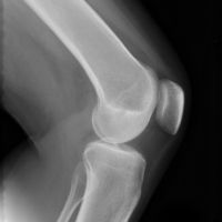Good price فیلم های Xray با وضوح بالا ، تصویربرداری پزشکی فیلم اشعه ایکس آبی برای چاپگر فوجی drypix 2000 آنلاین