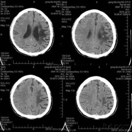 Good price فیلم تصویربرداری خشک فوجی آگفا 8in * 10in ، X Ray و فیلم حرارتی پزشکی برای چاپگر DICOM آنلاین