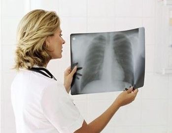 Good price فیلم تصویربرداری تشخیصی پزشکی با لیزر 20 25 25 سانتیمتر ضد آب نازک آنلاین