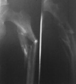Good price فیلم پرینتر حرارتی 43cm x 35cm ، فیلم X-ray پزشکی فوجی خشک آنلاین
