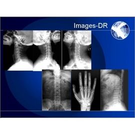 Good price دستگاه رادیوگرافی دیجیتال Mammogrpahy X-RAY با بازوی انعطاف پذیر UC آنلاین