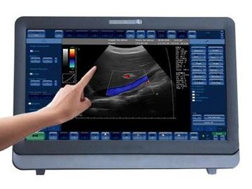 Good price سیستم سونوگرافی داپلر رنگی 3D / 4D پزشکی قابل حمل با مانیتور LED 15 اینچ آنلاین