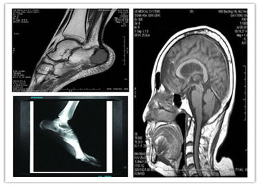 Good price فیلم تصویربرداری خشک آبی پایه دیجیتال پزشکی 8 10 10in اسکن سازگار Hosipital Mri آنلاین