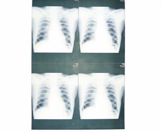 Good price White Base Medical Paper X Paper Paper Moistureproof برای چاپگر لیزری سونی / EPSON آنلاین