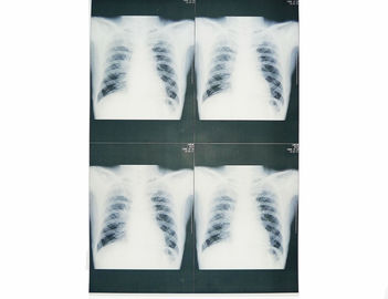 تصویربرداری تشخیصی پزشکی 20cm x 25cm ، لیزر پرینتر فیلم X پرتوی کاغذ