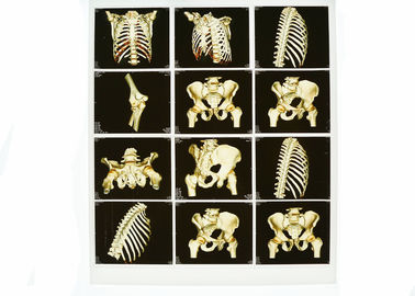 قابلیت تصویربرداری تشخیصی و پوشیدنی White Base X ray ، لیزر پزشکی فیلم Blue X X ray