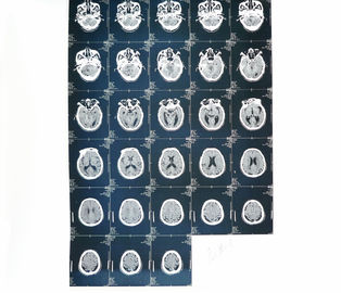 کاغذ پزشکی لیزر پرینتر تصویربرداری تشخیصی X Ray برای بیمارستان