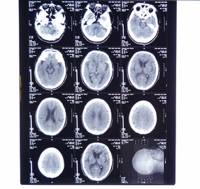 فیلم فوجی / آگفا ایکس ری ، فیلم پرینتر ترمینال خشک 8 در x 10in پزشکی