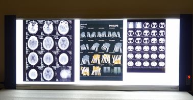 Good price پرینتر لیزری آبی لیزر فیلم پرینتر حرارتی X ray Medical X پرینتر آنلاین