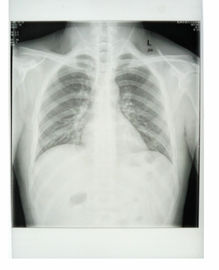 Good price پرینتر لیزری کونیدا لیزر فیلم X-ray 11in x 14in KND-K CE تایید شده است آنلاین