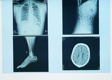 تصویربرداری تشخیصی با دوام اشعه ایکس با دوام ، لیزر کاغذی پزشکی 32 سانتی متر 43 سانتی متر از فیلم لیزر آبی اشعه ایکس