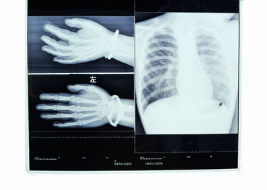 مه چاپگر 14in * 17in تصویربرداری پزشکی فیلم پرینتر حرارتی شفافیت با اشعه ایکس خشک