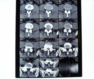 Good price فیلم پرینتر حرارتی خشک و پرتو ایکس پزشکی با چگالی بالا 8in * 10in 14in * 17in آنلاین