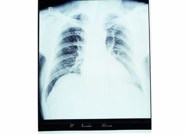 Good price رادیولوژی تصویربرداری تشخیصی پزشکی X ray برای AGFA / FUJI 2000 آنلاین