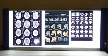 شفافیت بالا فیلم شفافیت X-ray پزشکی کونیدا شفافیت برای چاپگر AGFA / فوجی