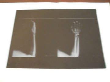 KND-A فیلم کم رنگ تصویربرداری پزشکی مه ، برای آزمایش اشعه ایکس در AGFA 5300 11in × 14in