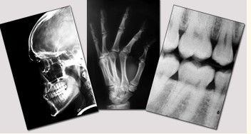 Good price فیلم تصویربرداری خشک آبی پزشکی ، فیلم لیزر فوجی Xin 11in x 14in آنلاین