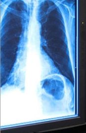 تصویربرداری با تابش آبی اشعه ایکس فیلم 11in x 17in برای چاپگر حرارتی